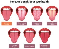 Understanding Bad Hygiene – Signs, Risks, and Solutions